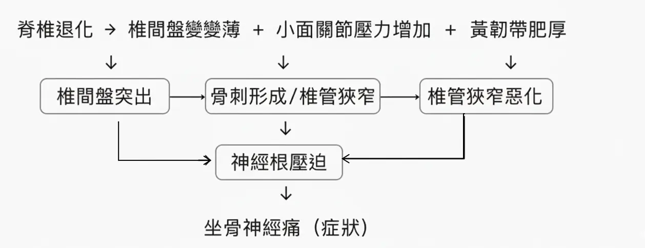 椎間盤突出、脊椎骨刺和坐骨神經痛比較表,說明三者定義與因果關係