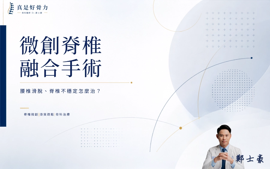 微創脊椎融合手術