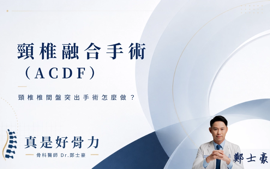 頸椎融合手術ACDF