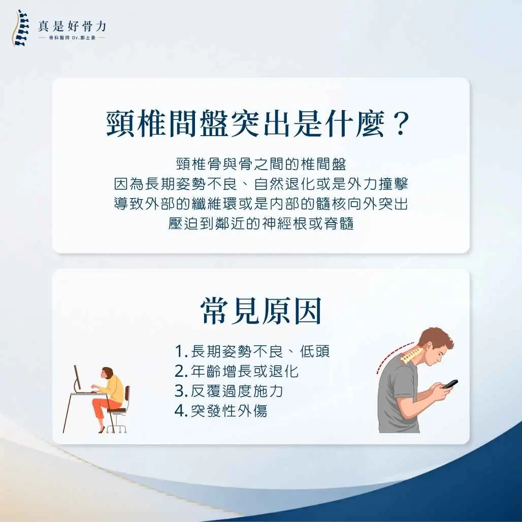 頸椎間盤突出是什麼？